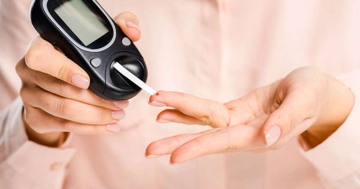 Representação de um pé afetado pela artropatia de Charcot, mostrando deformidades e inchaço.