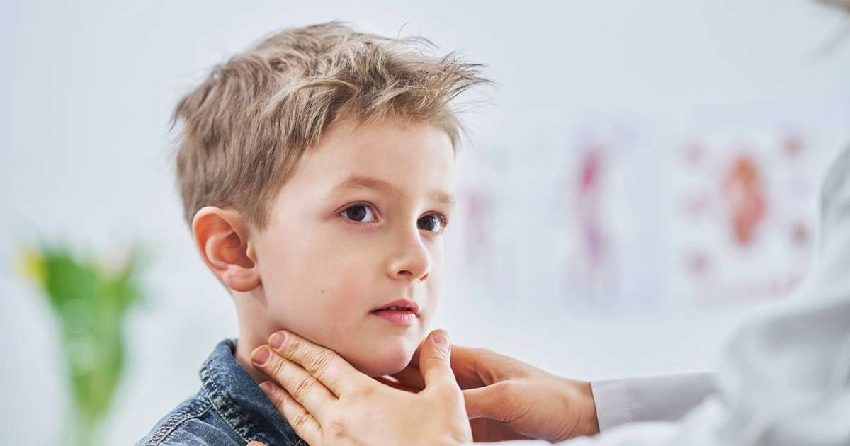 Imagem ilustrativa de uma glândula parótida inflamada devido à caxumba.