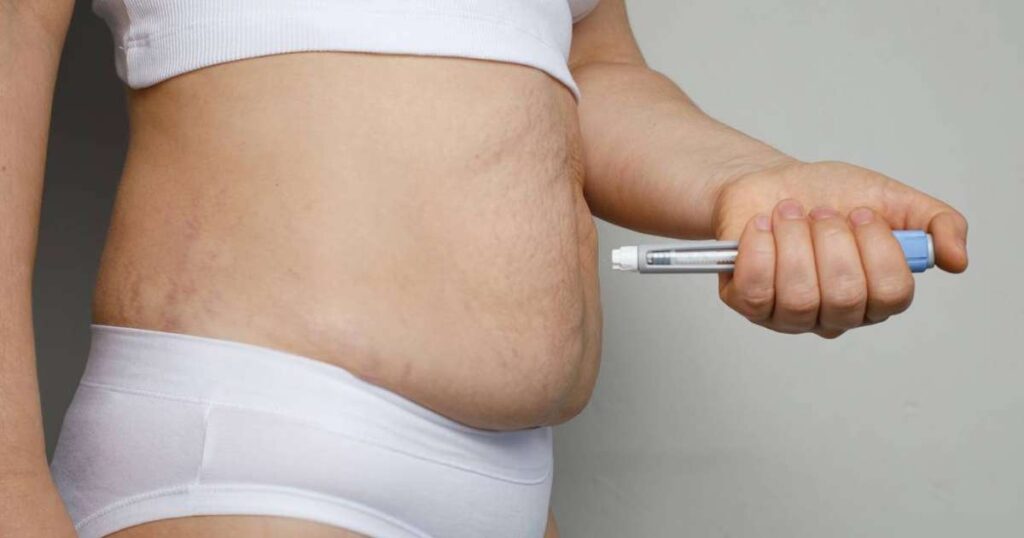 Imagem de canetas emagrecedoras não aprovadas pela ANVISA