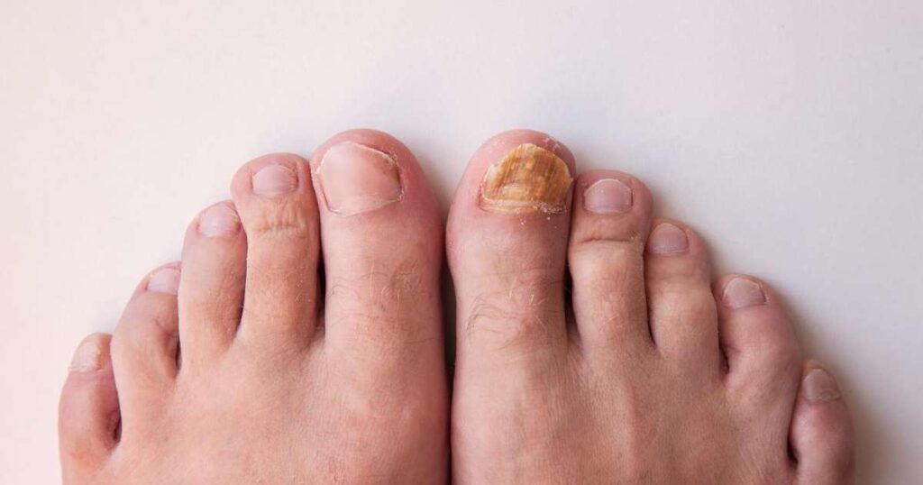 Unhas saudáveis e suas variações de aparência que indicam saúde e bem-estar